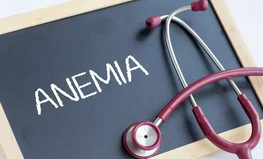 Slate with the word anemia and medical stethoscope on the table