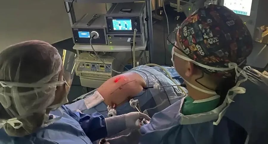 Cirujanos realizan un procedimiento laparoscópico guiado por monitores en un quirófano.