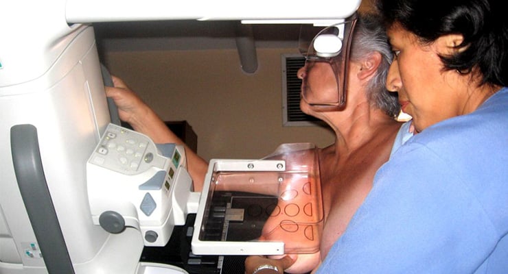 Mujer adulta realizándose una mamografía asistida por una profesional de la salud