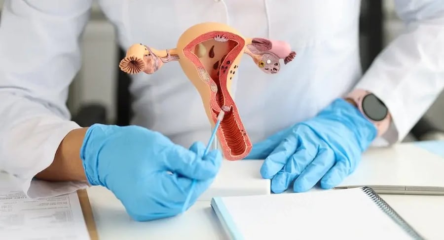 Gynecologist showing an anatomical model of the uterus and female reproductive tract