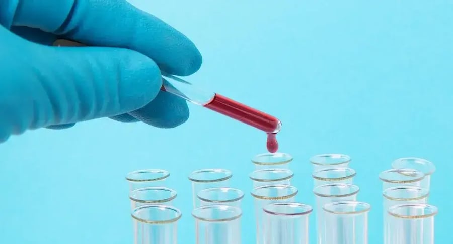 Blood sample in laboratory pipette ready for clinical analysis
