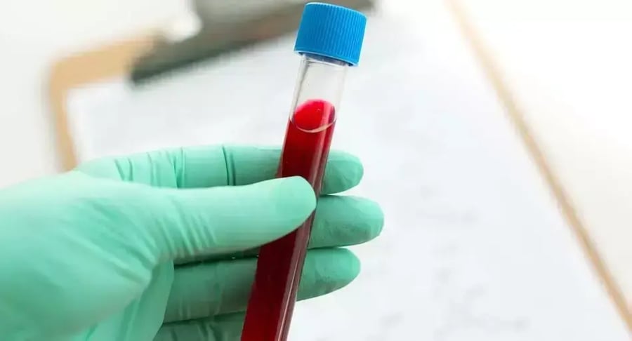 Blood sample in laboratory pipette ready for clinical analysis