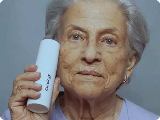 Mujer adulta mayor mostrando envase de crema dermatológica Curology para cuidado de la piel