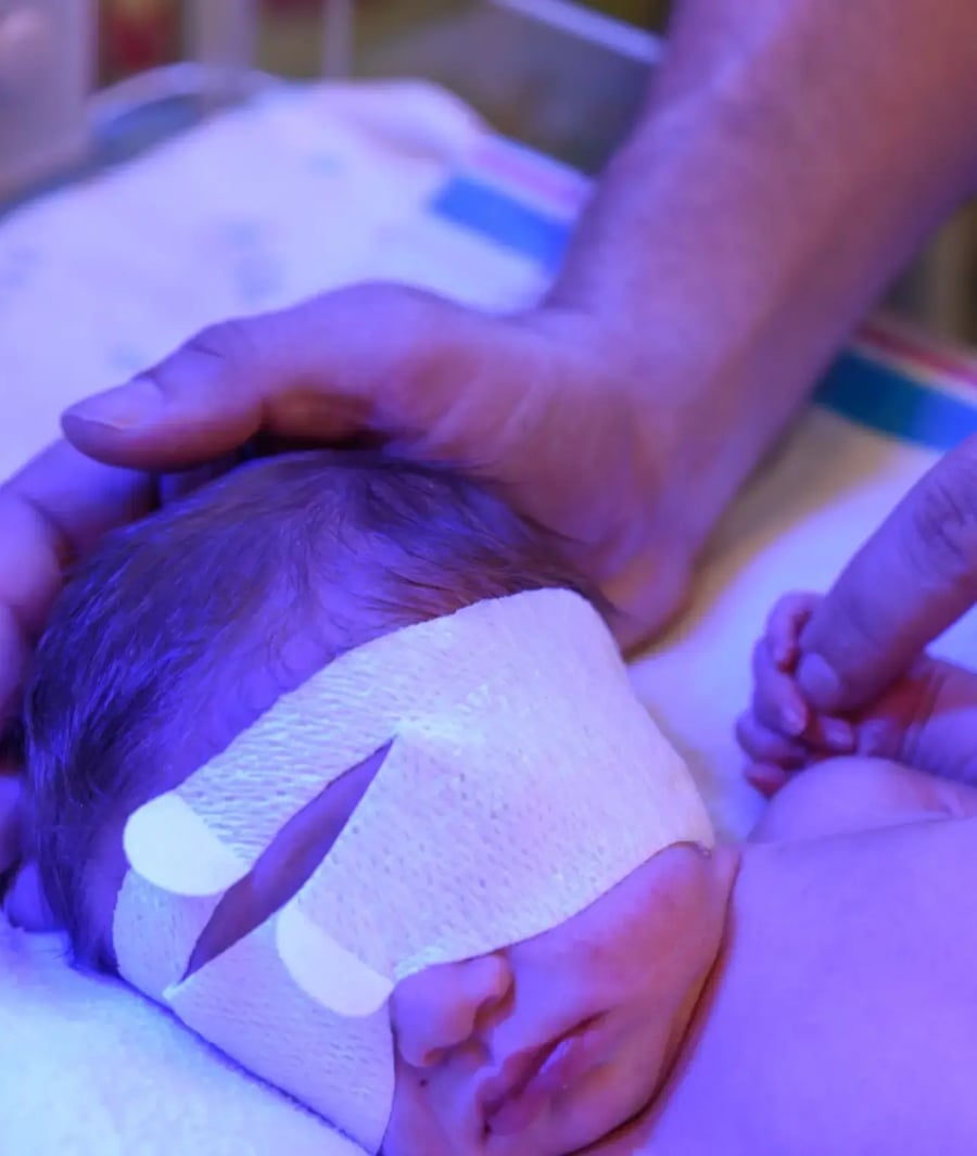 Newborn in incubator with protective mask under neonatal phototherapy