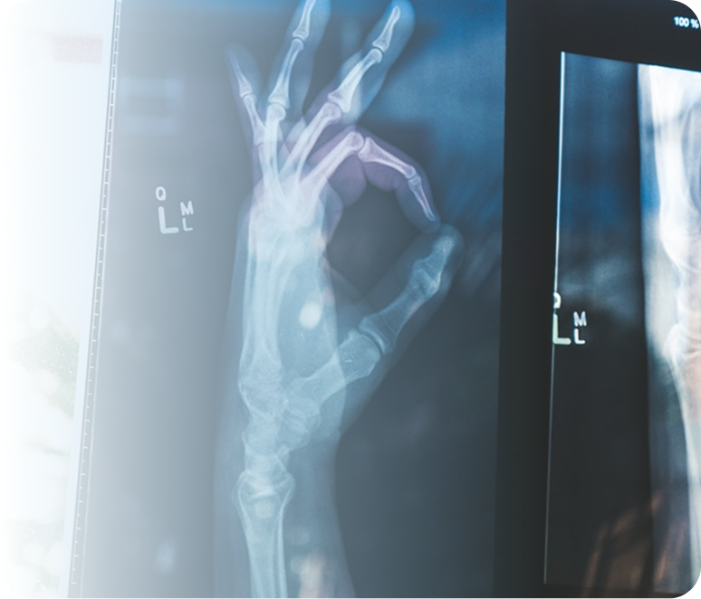 Radiografia